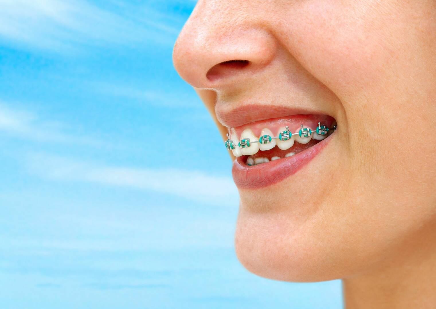 Best Dental Implants In North Little Rock AR