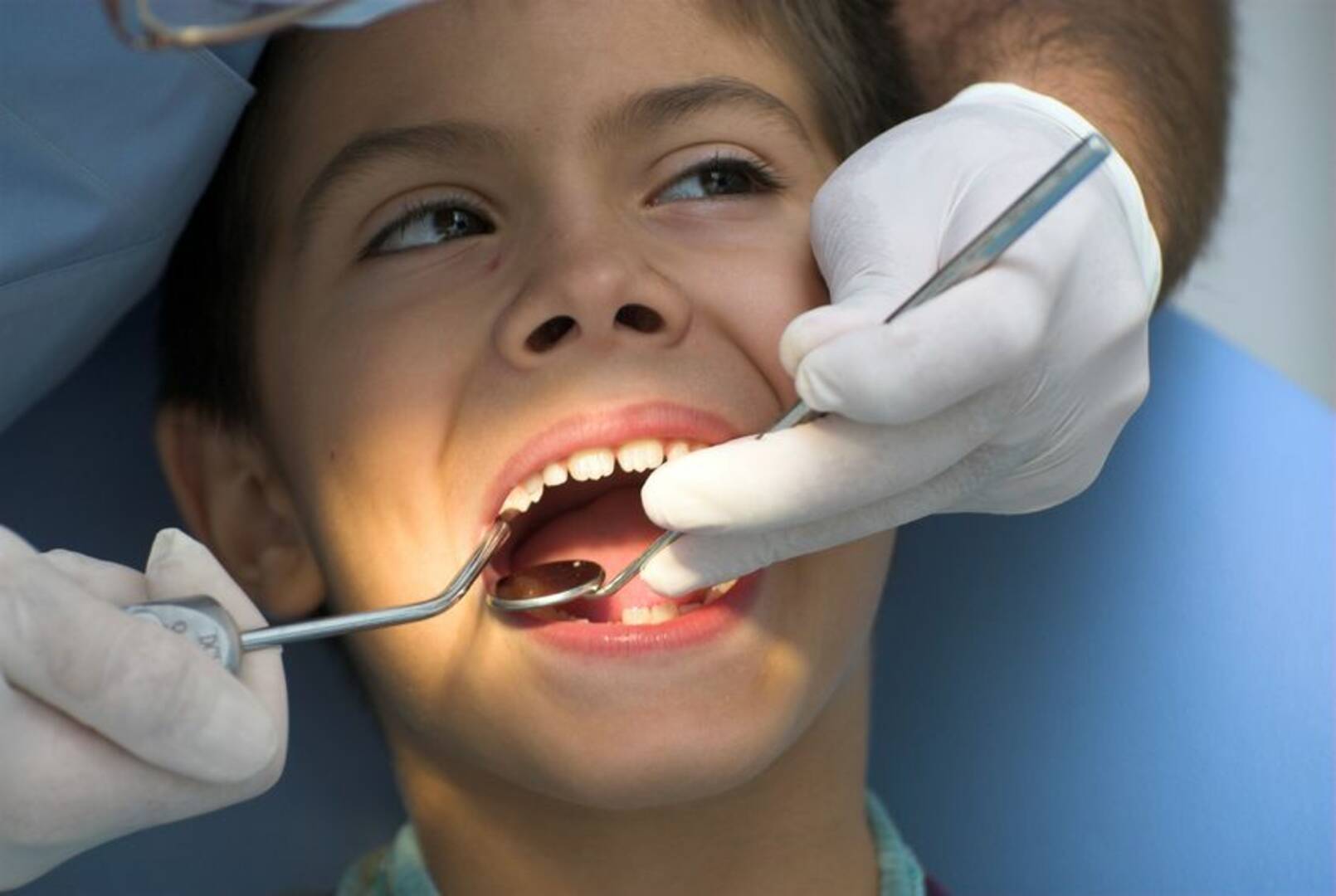 Wisdom Teeth Extractions San Diego Ca